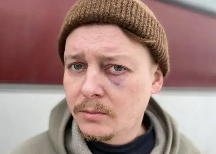 Актора, якого побив директор театру в Дніпрі, забрав заяву з поліції