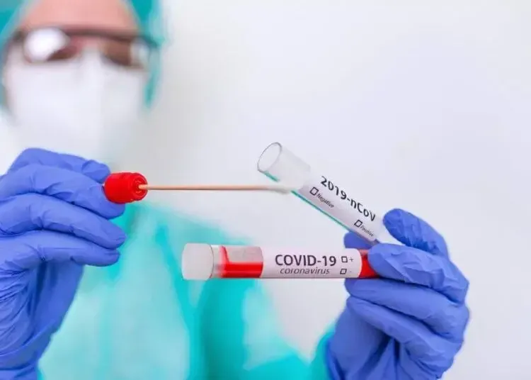 На Дніпропетровщині троє людей померли від COVID-19