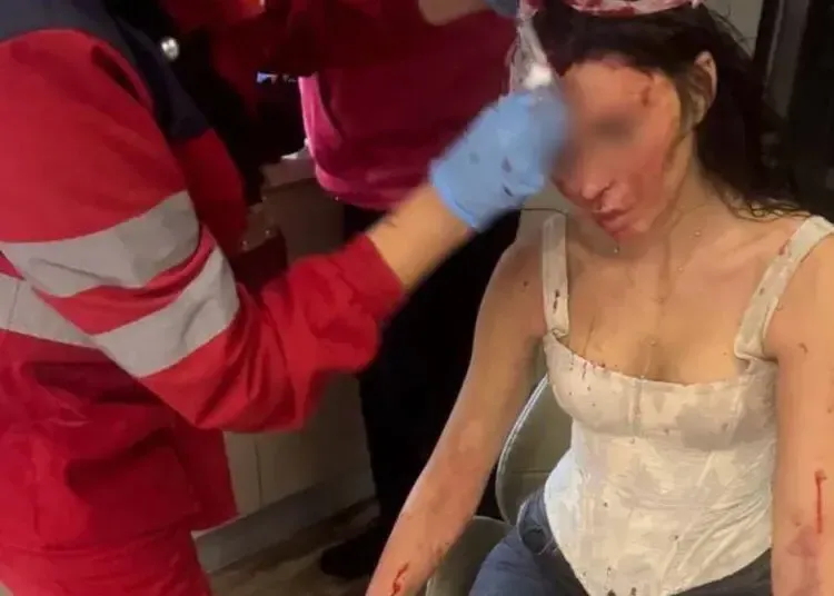 Мешканку Кривого Рогу жорстоко побив колишній хлопець