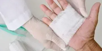 Ускорение заживления ран — почему это важно