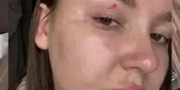 На Дніпропетровщині жінки напали на блогерку через відео про захисні сітки