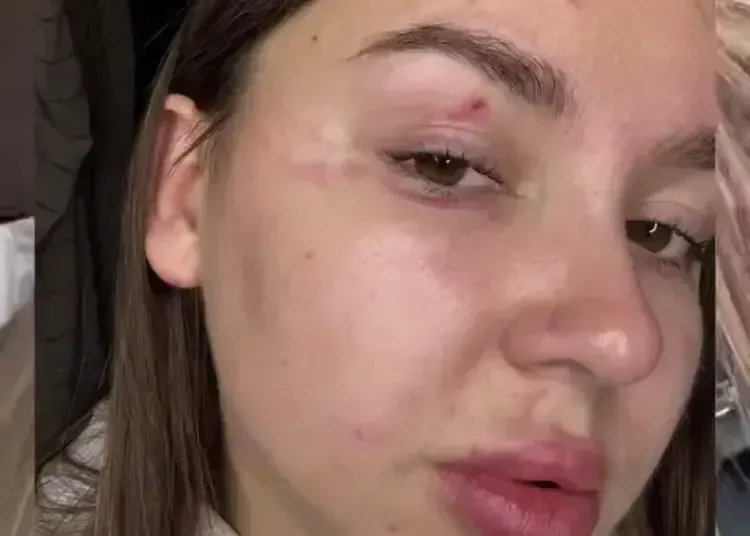 На Дніпропетровщині жінки напали на блогерку через відео про захисні сітки