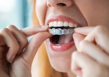 Елайнери Invisalign: повний гайд для споживача